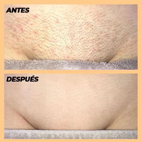 DEPILADORA PROFESIONAL FINISHING TOUCH